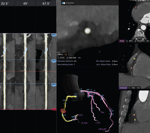 SWFLCIS Knoxville 2026